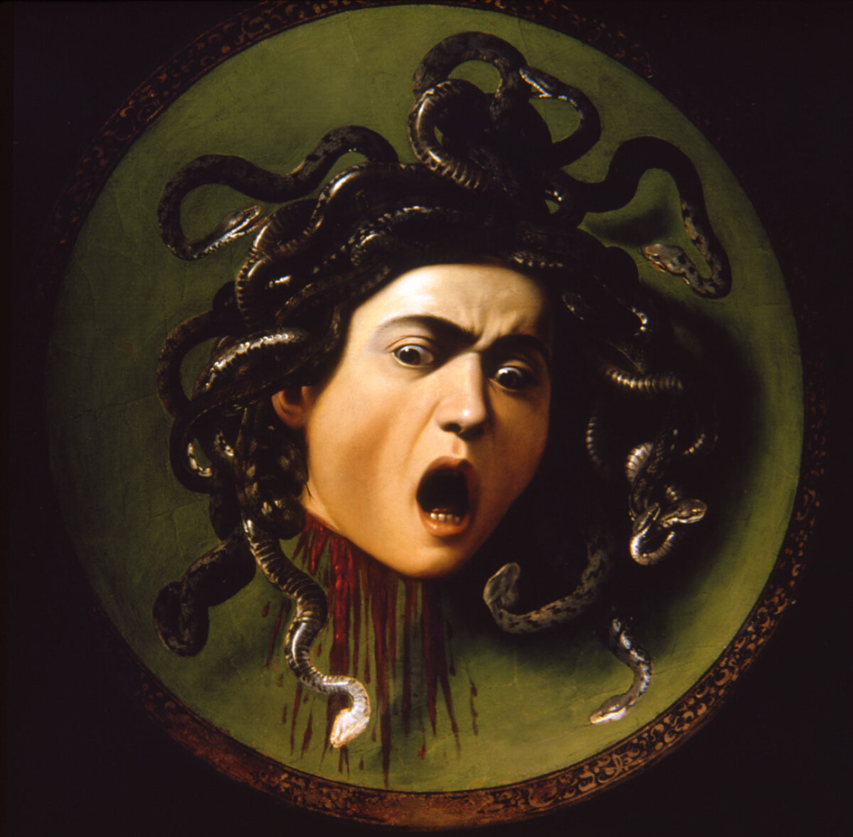Medusa